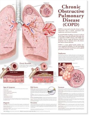 Chronic Obstructive Pulmonary Disease Chart 2E