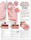 Chronic Obstructive Pulmonary Disease Anatomical Chart, 2e | ABC Books