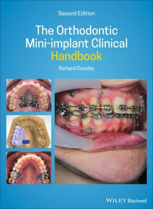 The Orthodontic Mini-implant Clinical Handbook 2nd Edition