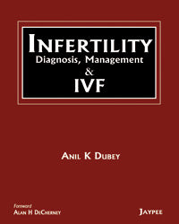 Infertility: Diagnosis, Management and IVF