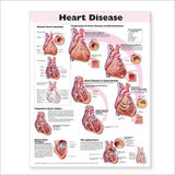 Heart Disease Anatomical Chart, 2e