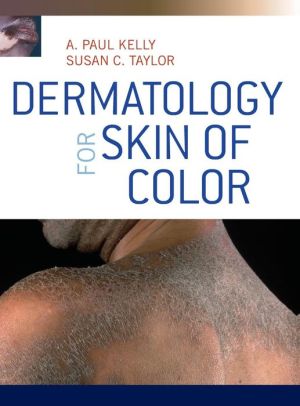 Dermatology for Skin of Color **