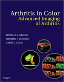 Arthritis in Color: Advanced Imaging of Arthritis **