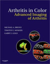Arthritis in Color: Advanced Imaging of Arthritis ** | ABC Books