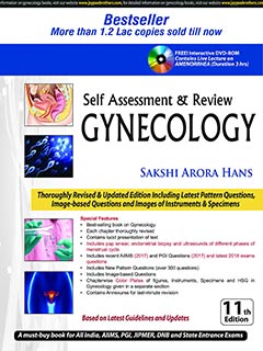 Self-Assessment & Review Gynecology (Free Interactive DVD-ROM), 11e** | ABC Books