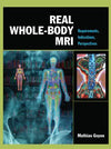 Real Whole Body MRI