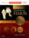 Fractures of the Proximal Femur: Improving Outcomes **