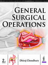 General Surgical Operations, 2e
