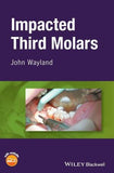 Third Molar Extraction | ABC Books