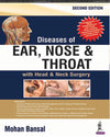 Diseases of Ear, Nose and Throat, 2e