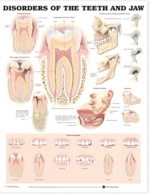 Disorders of the Teeth and Jaw Anatomical Chart | ABC Books