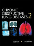 Chronic Obstructive Lung Disease, 2e | ABC Books