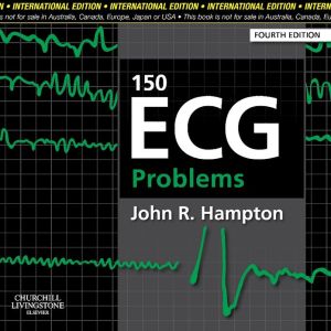 150 ECG Problems (IE), 4e**