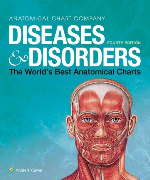 Diseases & Disorders : The World's Best Anatomical Charts, 4e | ABC Books