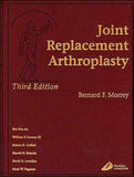 Joint Replacement Arthroplasty, 3e **