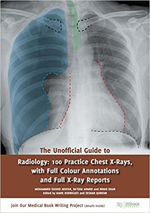 The Unofficial Guide to Radiology: 100 Practice Chest X Rays with Full Colour Annotations and Full X Ray Reports