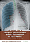 The Unofficial Guide to Radiology: 100 Practice Chest X Rays with Full Colour Annotations and Full X Ray Reports | ABC Books