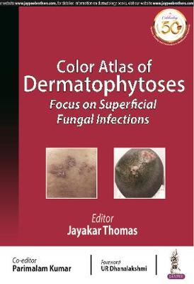 Color Atlas of Dermatophytoses: Focus on Superficial Fungal Infections | ABC Books