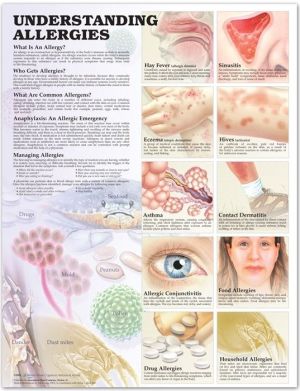 Understanding Allergies Anatomical Chart, 2e | ABC Books