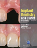 Implant Dentistry at a Glance, 2e | ABC Books