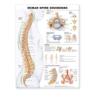 Human Spine Disorders Anatomical Chart Human Spine Disorders Anatomical Chart