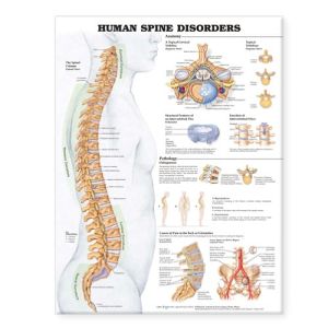 Human Spine Disorders Anatomical Chart | ABC Books