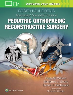 Boston Children's Illustrated Tips and Tricks in Pediatric Orthopaedic Reconstructive Surgery | ABC Books