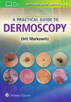 A Practical Guide to Dermoscopy