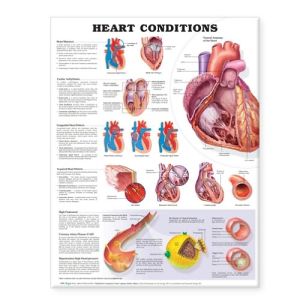 Heart Conditions Chart