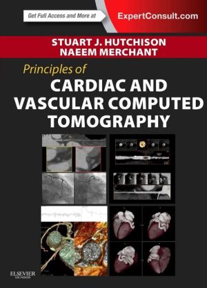 Principles of Cardiac and Vascular Computed Tomography**