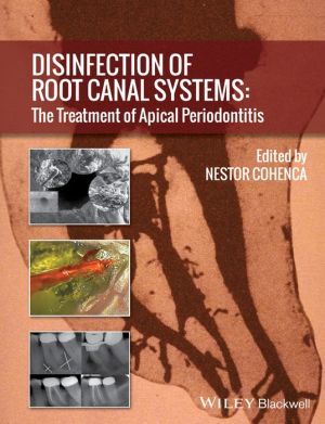 Disinfection of Root Canal Systems: The Treatment of Apical Periodontitis