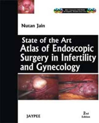 State of The Art Atlas and Endoscopy Surgery in Infertility and Gynecology With 4 DVD-ROMs 2/e
