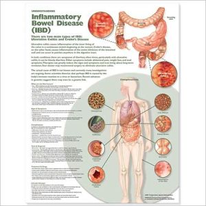 Understanding Inflammatory Bowel Disease (IBD) Chart