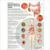 Understanding Inflammatory Bowel Disease (IBD) Anatomical Chart | ABC Books