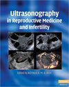 Ultrasonography in Reproductive Medicine and Infertility | ABC Books