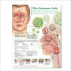 Understanding the Common Cold Chart 2E