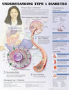 Understanding Type 1 Diabetes Anatomical Chart, 3e | ABC Books