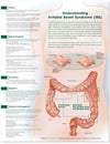 Understanding Irritable Bowel Syndrome Anatomical Chart**