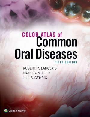Color Atlas of Common Oral Diseases, 5E