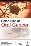 Color Atlas of Oral Cancer | ABC Books