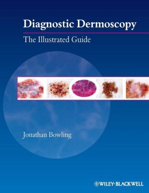 Diagnostic Dermoscopy: The Illustrated Guide