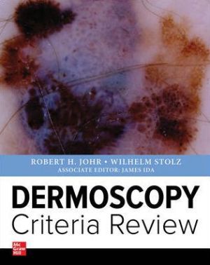 Dermoscopy Criteria Revie | ABC Books