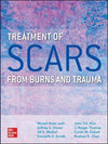 Treatment of Scars from Burns and Trauma | ABC Books