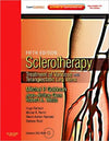 Sclerotherapy Treatment of Varicose and Telangiectatic Leg Veins, 5e **