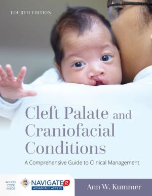 Cleft Palate and Craniofacial Conditions, 4e