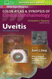 Color Atlas and Synopsis of Clinical Ophthalmology: Uveitis 2E | ABC Books