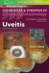Color Atlas and Synopsis of Clinical Ophthalmology: Uveitis 2E