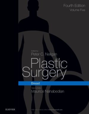 Plastic Surgery : Volume 5: Breast, 4e | ABC Books
