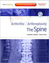 Arthritis and Arthroplasty: The Spine ** | ABC Books