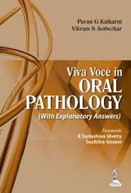 Viva Voce in Oral Pathology